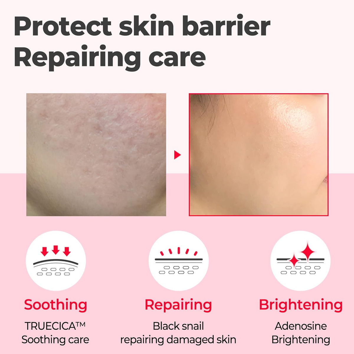 SOME BY MI Snail Truecica Miracle Repair Serum 50mL SOMEBYMI