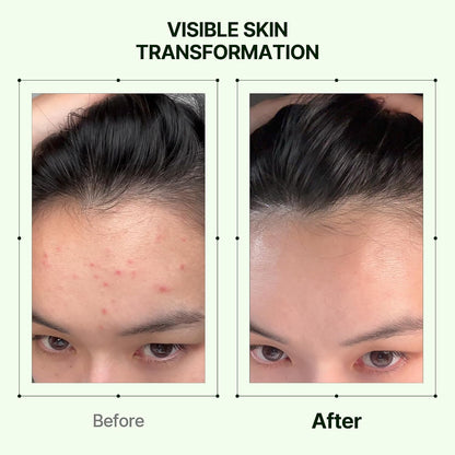 Orien Mugwort Zero Film Toner 160ml lightweight Korean facial toner for refreshing hydration and comfortable skin preparation in UAE.