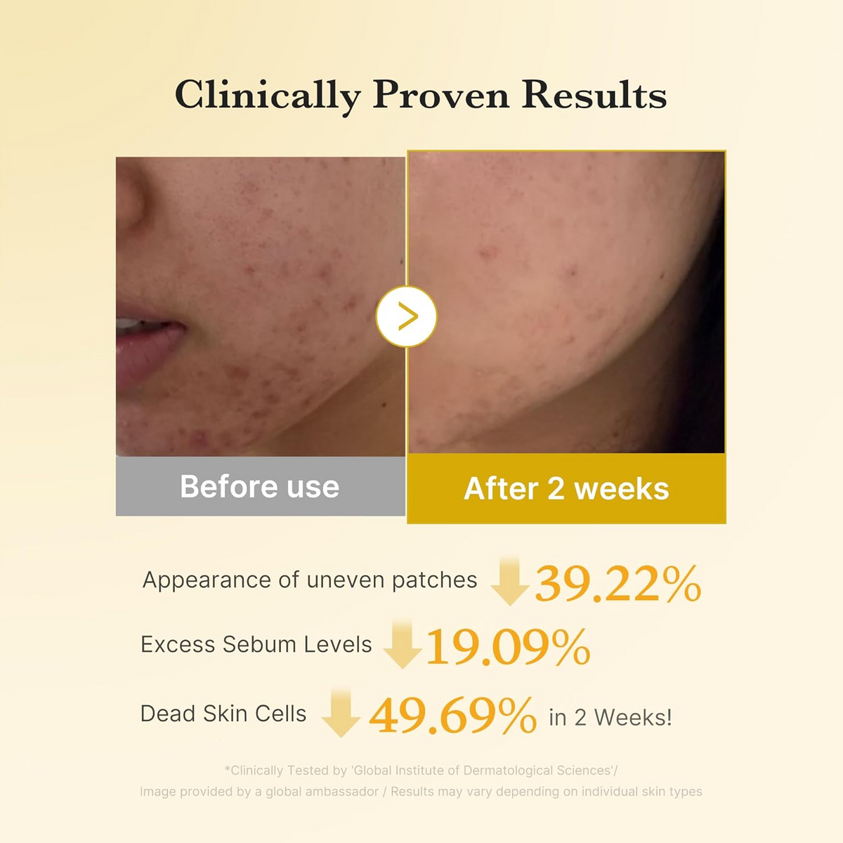 before and after comparison of medicube Kojic Acid Turmeric Pads on skin
