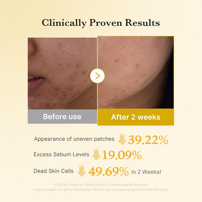 before and after comparison of medicube Kojic Acid Turmeric Pads on skin