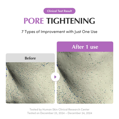 before and after comparision of pore tightening 