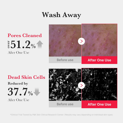 Before and after effects of medicube Red Foam Cleanser on skin pores and dead skin cells 