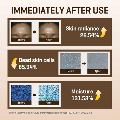 SOME BY MI Galactomyces Pure Vitamin C Glow Toner 200mL SOMEBYMI