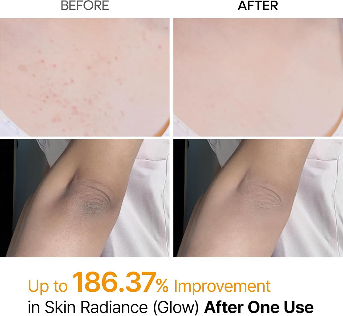Before and after of Kojic acid and turmeric body exfoliator 200ml UAE