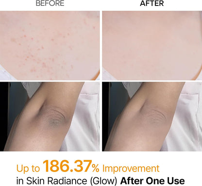 Before and after of Kojic acid and turmeric body exfoliator 200ml UAE