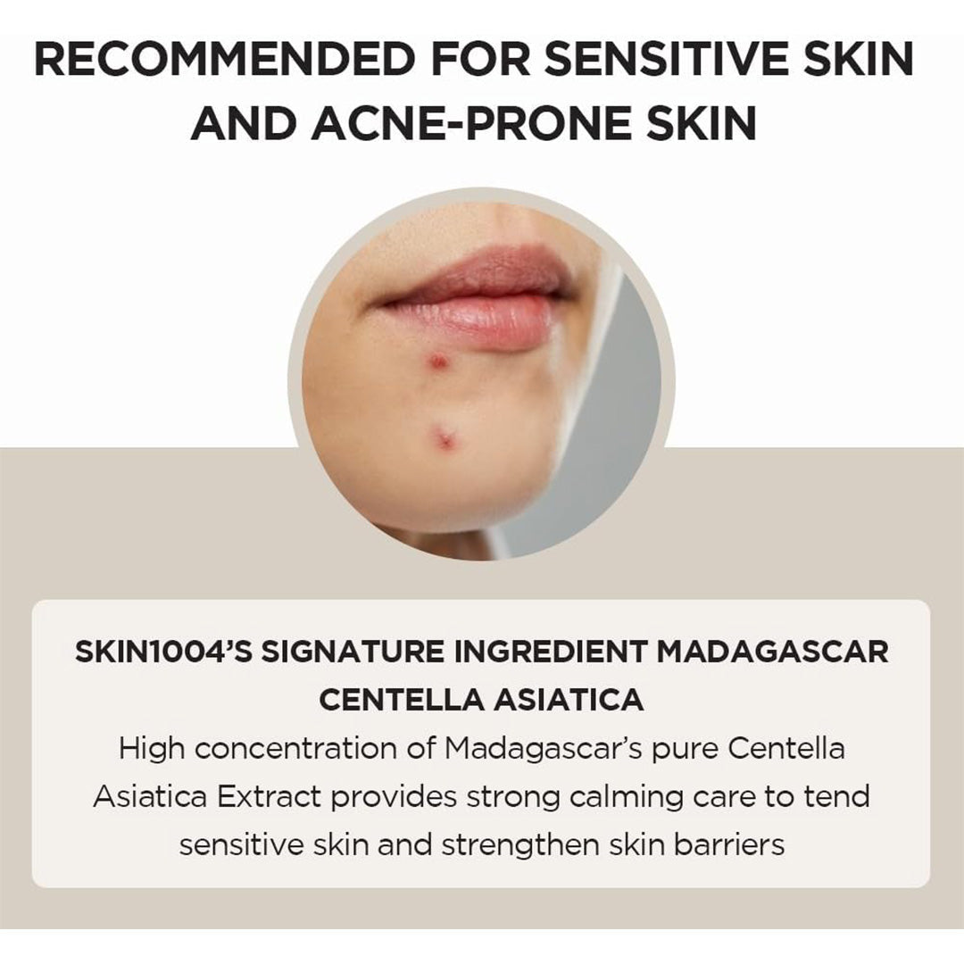 close-up of acne-proned skin