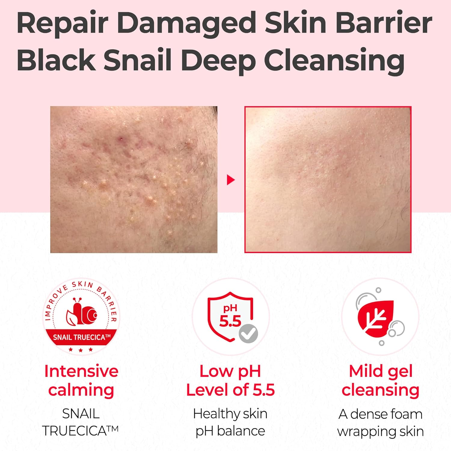 SOME BY MI Snail Truecica Miracle Repair Low pH Gel Cleanser 100mL SOMEBYMI