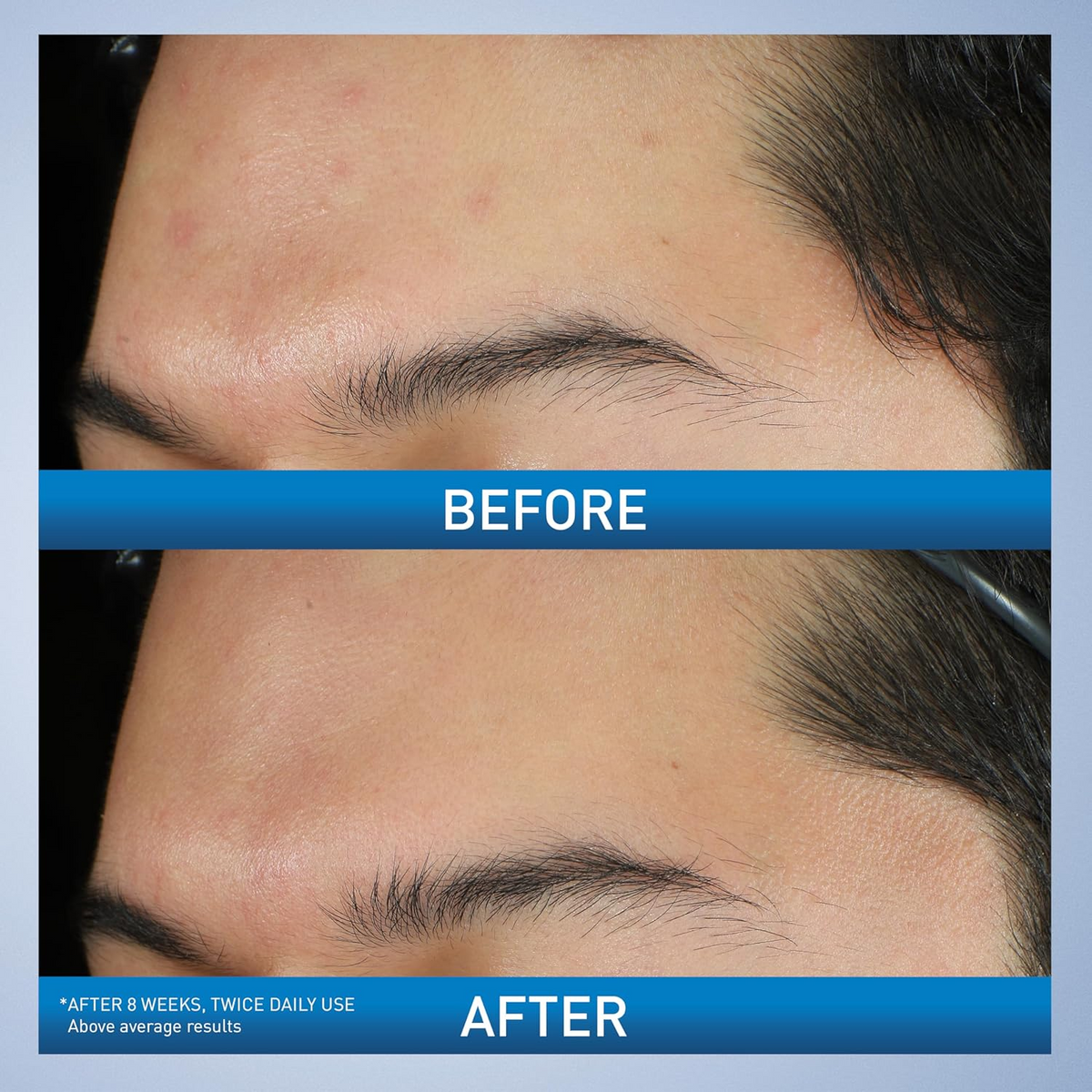 two images of before and after skin comparision 