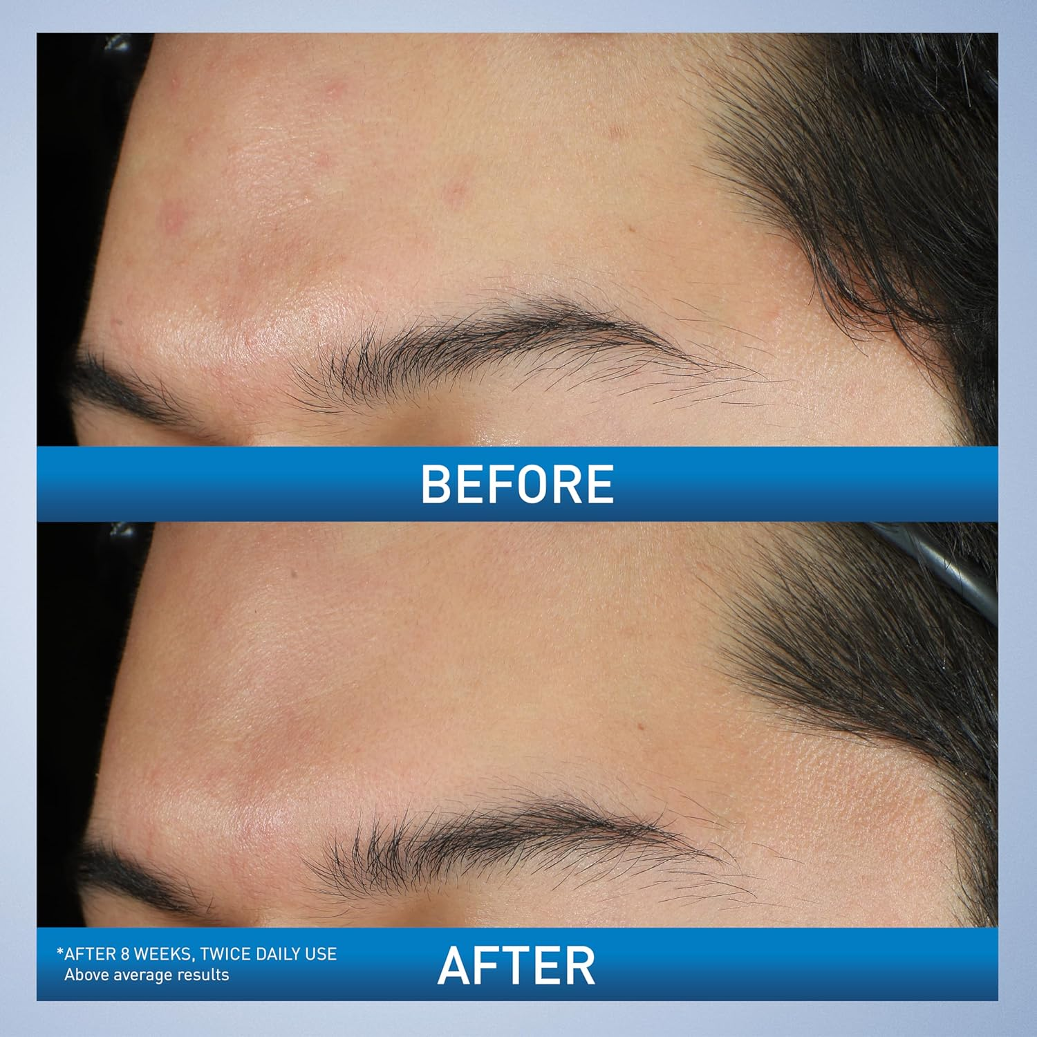 two images of before and after skin comparision 