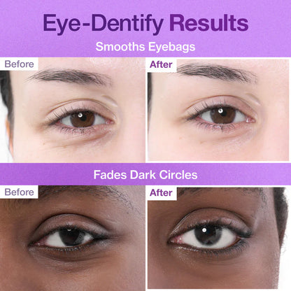 Numbuzin No.9 3 Days Eye Care Kit | Intensive Firming & Wrinkle Care for Eyes