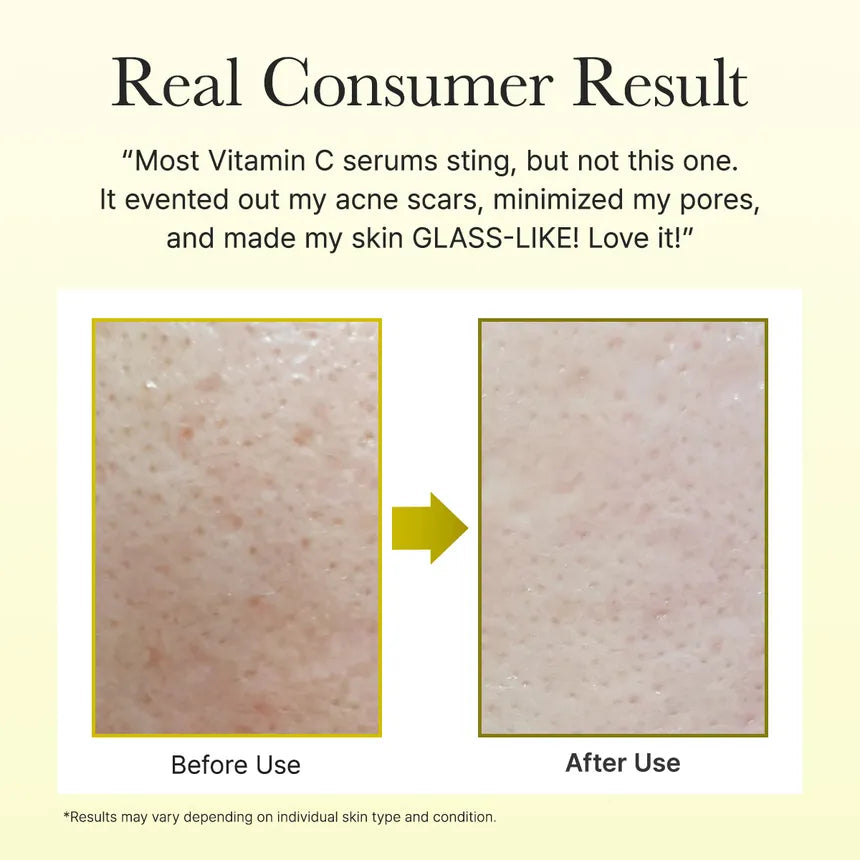 Before and after skin comparison with text about a arencia vitamin C serum's effectiveness.