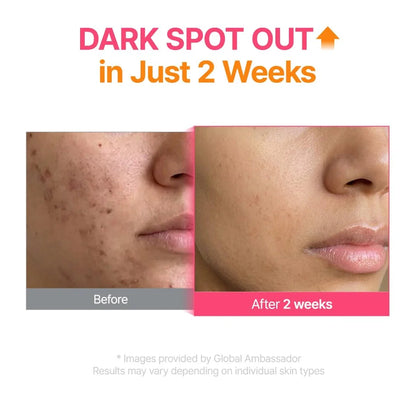 PURITO TXA serum for post acne marks Abu Dhabi