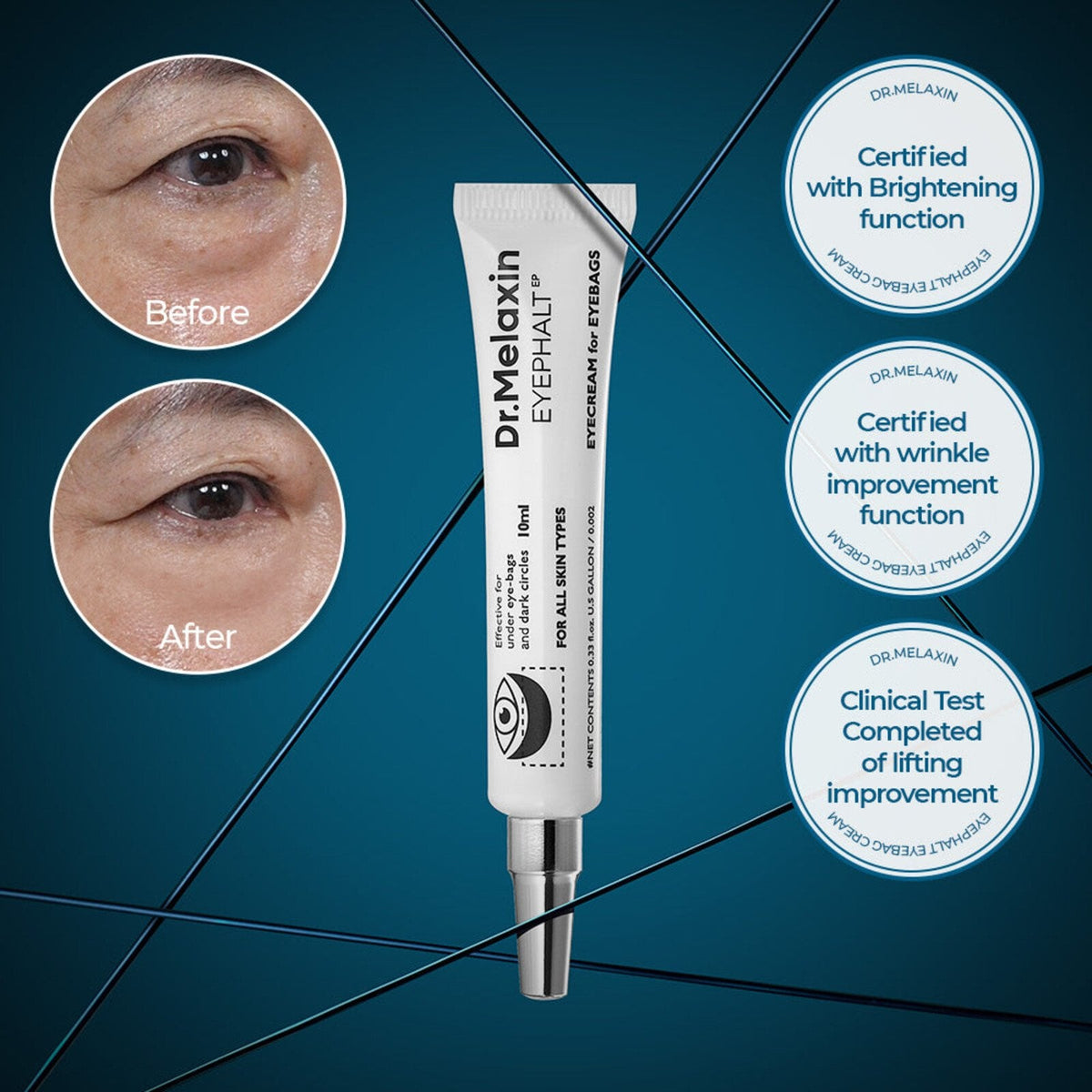 Korean eye cream for puffiness and dark circles UAE