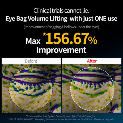 Dr. Melaxin under-eye bag lifting cream Dubai