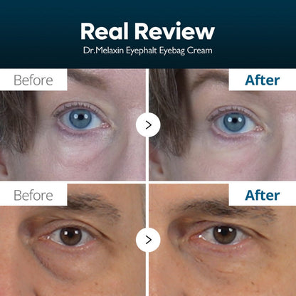 Firming eye cream for fine lines Abu Dhabi