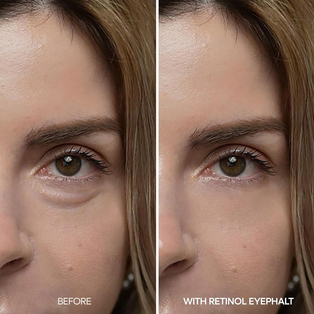 Dr. Melaxin Eyephalt Retinol Eyebag Cream 10g UAE
