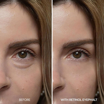 Dr. Melaxin Eyephalt Retinol Eyebag Cream 10g UAE