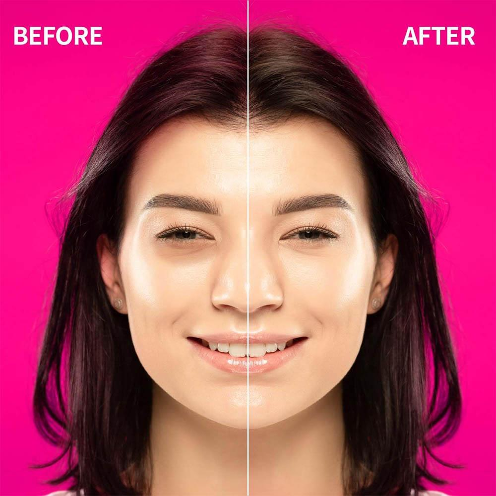 Ultru I'm Sorry For My Skin Hydrogel Eye Patch Brightening 90mL | Brightening & Hydrating Eye Patches UAE