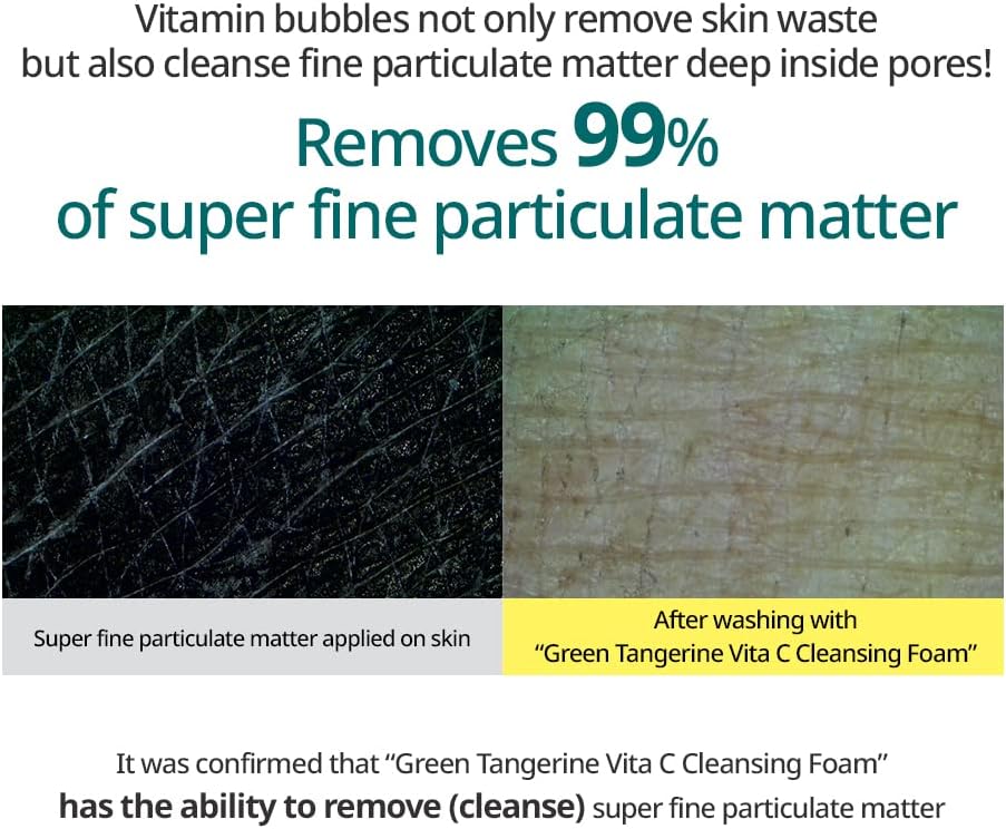 removes 99% of super fine particulate matter