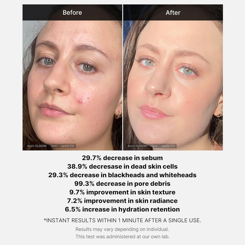 medicube Red Acne Succinic Acid Peel 40g (1.41 oz) MediCube