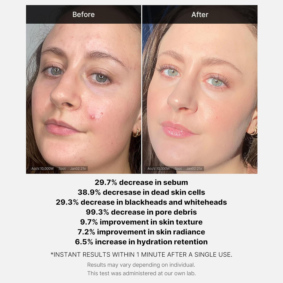 medicube Red Acne Succinic Acid Peel 40g (1.41 oz) MediCube