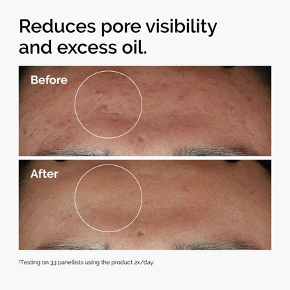 The Ordinary Niacinamide 10% + Zinc 1% Serum, 30 mL The Ordinary